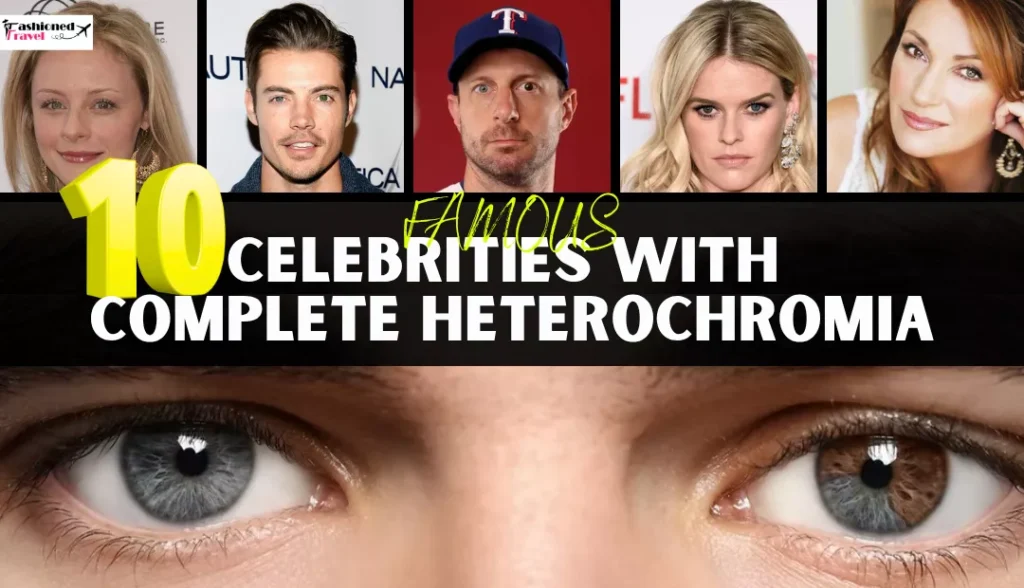 celebrities with complete heterochromia