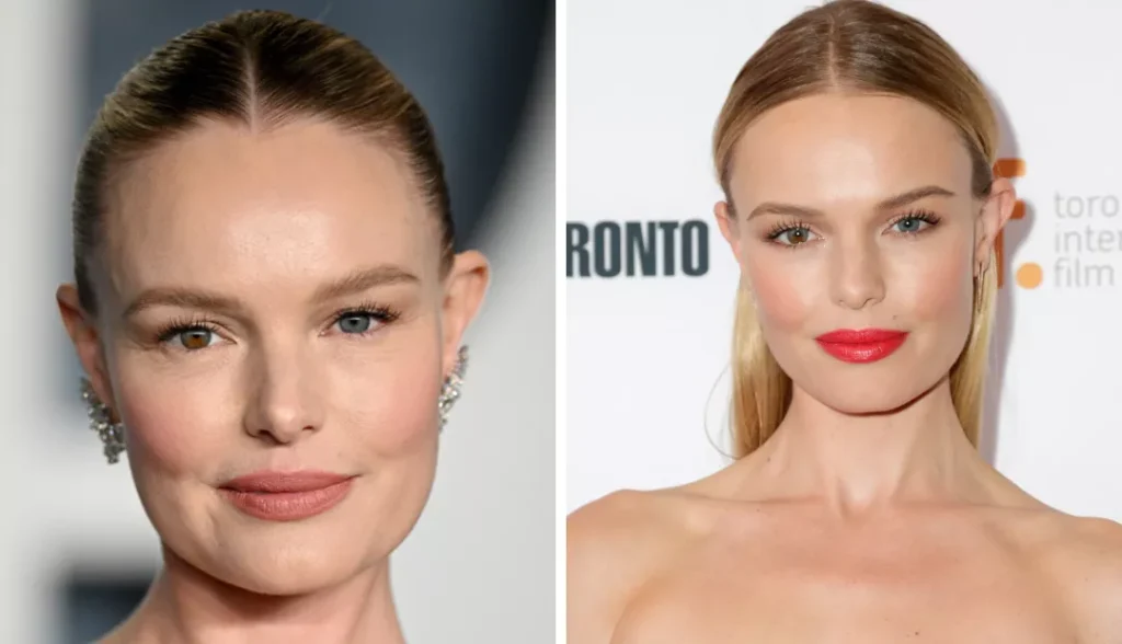 Kate Bosworth with complete heterochromia