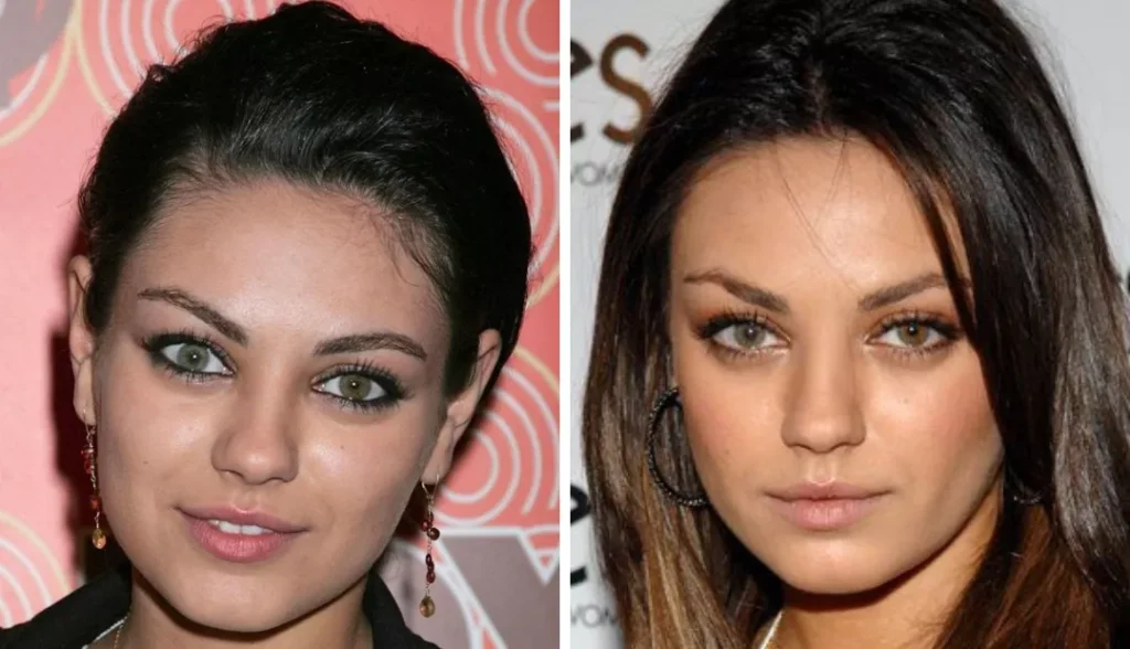 Mila Kunis with complete heterochromia